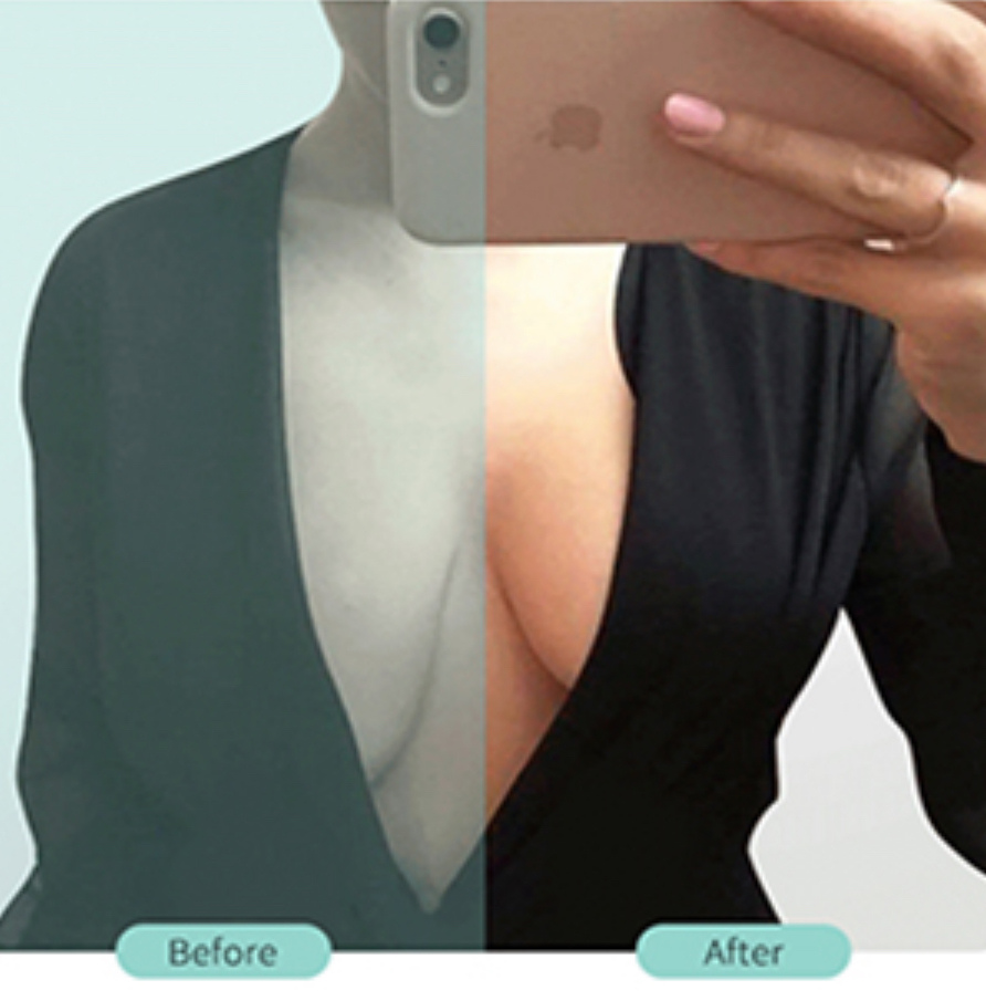 Ruban de levage de poitrine (8pcs x 7.5cm x 30cm) – Image 7