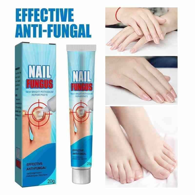 Pâte réparatrice pour les ongles – Soin des ongles 20 g